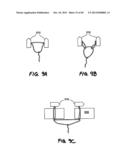 METHOD FOR THE TREATMENT OF TISSUE diagram and image