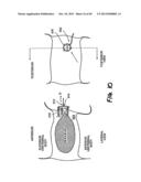 METHOD FOR THE TREATMENT OF TISSUE diagram and image