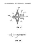 METHOD FOR THE TREATMENT OF TISSUE diagram and image