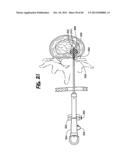 METHOD FOR THE TREATMENT OF TISSUE diagram and image