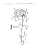 METHOD FOR THE TREATMENT OF TISSUE diagram and image