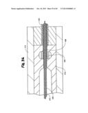 METHOD FOR THE TREATMENT OF TISSUE diagram and image