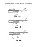 METHOD FOR THE TREATMENT OF TISSUE diagram and image