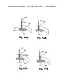 METHOD FOR THE TREATMENT OF TISSUE diagram and image