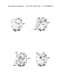 METHOD FOR THE TREATMENT OF TISSUE diagram and image