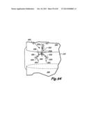 METHOD FOR THE TREATMENT OF TISSUE diagram and image