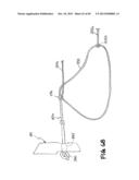 METHOD FOR THE TREATMENT OF TISSUE diagram and image