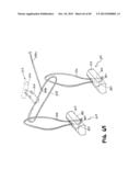 METHOD FOR THE TREATMENT OF TISSUE diagram and image