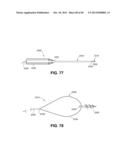 METHOD FOR THE TREATMENT OF TISSUE diagram and image