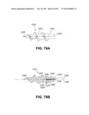 METHOD FOR THE TREATMENT OF TISSUE diagram and image