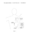 SYSTEMS AND METHODS FOR CONTROLLING SPINAL CORD STIMULATION TO IMPROVE     STIMULATION EFFICACY FOR USE BY IMPLANTABLE MEDICAL DEVICES diagram and image