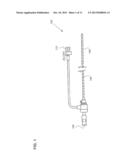 Apparatus and Method of Treating a Vein with Heat Energy diagram and image