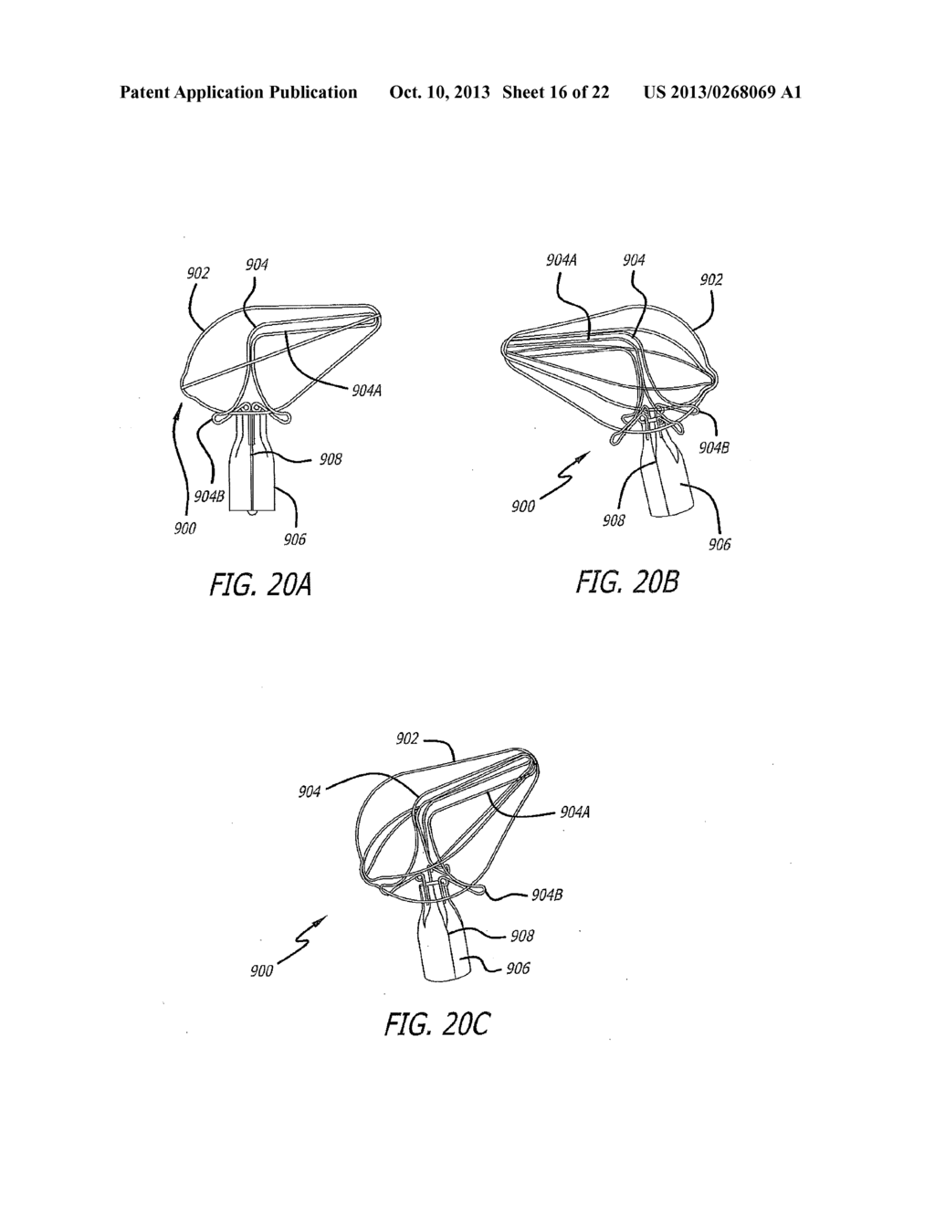 DEVICE AND METHOD FOR REDUCING MITRAL VALVE REGURGITATION - diagram, schematic, and image 17