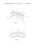 LOAD SHARING INTERBODY FUSION DEVICE diagram and image