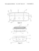 LOAD SHARING INTERBODY FUSION DEVICE diagram and image