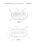 LOAD SHARING INTERBODY FUSION DEVICE diagram and image