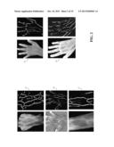 Fast and Robust Classification Algorithm for Vein Recognition Using     Infrared Images diagram and image