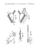 Cleanup system diagram and image