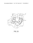 Miter Saw with Cutting Alignment Device on a Dust Chute diagram and image