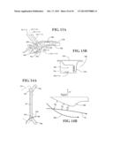 CONSTRUCTION METHOD TO CONTROL FRONT ENGINE COMPARTMENT DEFORMATION diagram and image