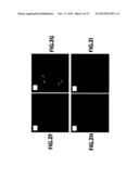 INSULIN PRODUCING CELLS DERIVED FROM PLURIPOTENT STEM CELLS diagram and image