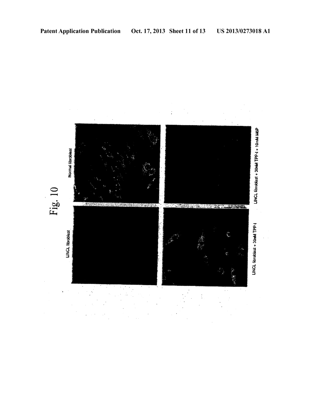 RECOMBINANT HUMAN CLN2 PROTEIN AND METHODS OF ITS PRODUCTION AND USE - diagram, schematic, and image 12