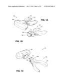 METHOD AND DEVICE FOR INCREASING BONE DENSITY IN THE MOUTH diagram and image