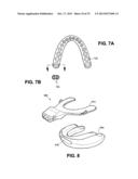 METHOD AND DEVICE FOR INCREASING BONE DENSITY IN THE MOUTH diagram and image