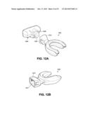 METHOD AND DEVICE FOR INCREASING BONE DENSITY IN THE MOUTH diagram and image