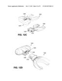 METHOD AND DEVICE FOR INCREASING BONE DENSITY IN THE MOUTH diagram and image