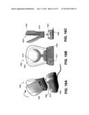 METHOD AND DEVICE FOR INCREASING BONE DENSITY IN THE MOUTH diagram and image