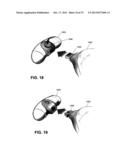 METHOD AND DEVICE FOR INCREASING BONE DENSITY IN THE MOUTH diagram and image