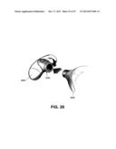 METHOD AND DEVICE FOR INCREASING BONE DENSITY IN THE MOUTH diagram and image