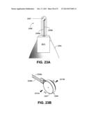 METHOD AND DEVICE FOR INCREASING BONE DENSITY IN THE MOUTH diagram and image