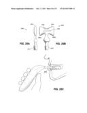 METHOD AND DEVICE FOR INCREASING BONE DENSITY IN THE MOUTH diagram and image