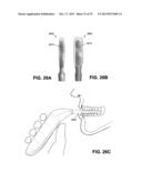 METHOD AND DEVICE FOR INCREASING BONE DENSITY IN THE MOUTH diagram and image