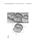 SYSTEM AND METHOD FOR EVALUATING ORTHODONTIC TREATMENT diagram and image