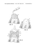 PRELOADED DENTAL CAP AND RETRACTION MATERIAL FOR GINGIVAL TISSUE     RETRACTION diagram and image