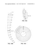 Swaggering Endodontic Instruments diagram and image