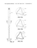 Swaggering Endodontic Instruments diagram and image