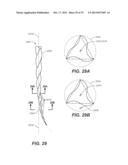 Swaggering Endodontic Instruments diagram and image