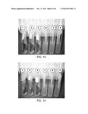 DENTAL PROBE, A METHOD OF FORMING THE PROBE AND A METHOD OF USING THE     PROBE diagram and image