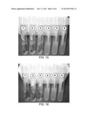 DENTAL PROBE, A METHOD OF FORMING THE PROBE AND A METHOD OF USING THE     PROBE diagram and image