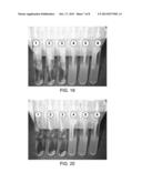 DENTAL PROBE, A METHOD OF FORMING THE PROBE AND A METHOD OF USING THE     PROBE diagram and image