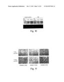 1L1RL-1 as a Cardiovascular Disease Marker and Therapeutic Target diagram and image