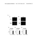 Screening Method for Candidate Agonist Compounds for Adiponectin Receptor     I diagram and image