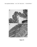 METHODS OF VALIDATING CANDIDATE COMPOUNDS FOR USE IN TREATING COPD AND     OTHER DISEASES diagram and image