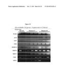 GENE EXPRESSION IN N-CADHERIN OVEREXPRESSING PROSTATE CANCERS AND THEIR     CONTROLS diagram and image