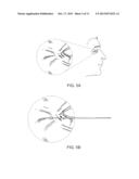 THREADS OF CROSS-LINKED HYALURONIC ACID AND METHODS OF PREPARATION AND USE     THEREOF diagram and image