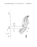 DETACHABLE DILATOR BLADE diagram and image